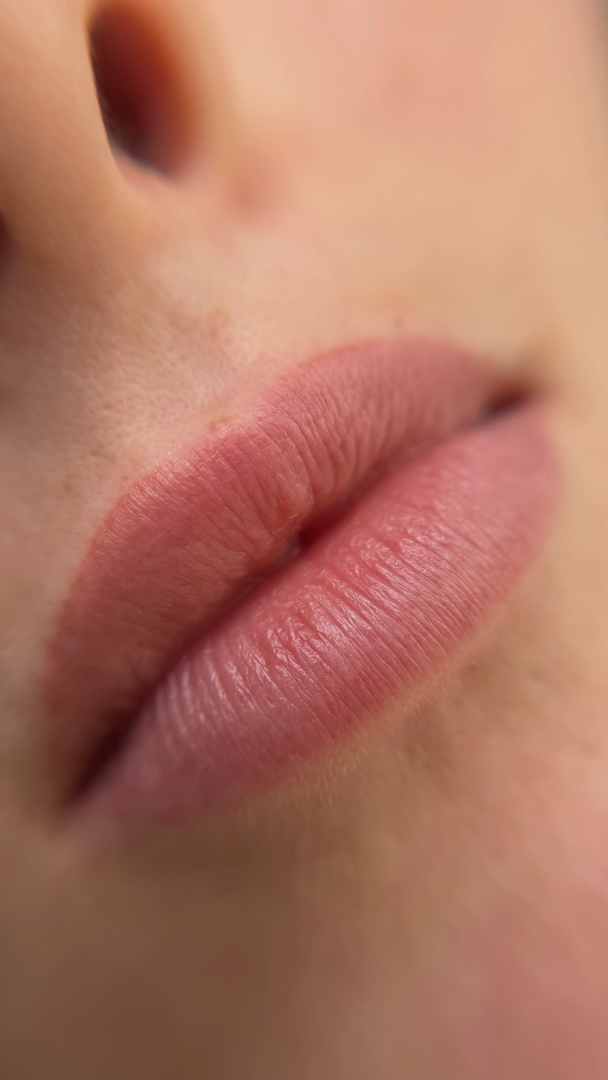 Abgeheilte Lippenpigmentierung, Nahaufnahme