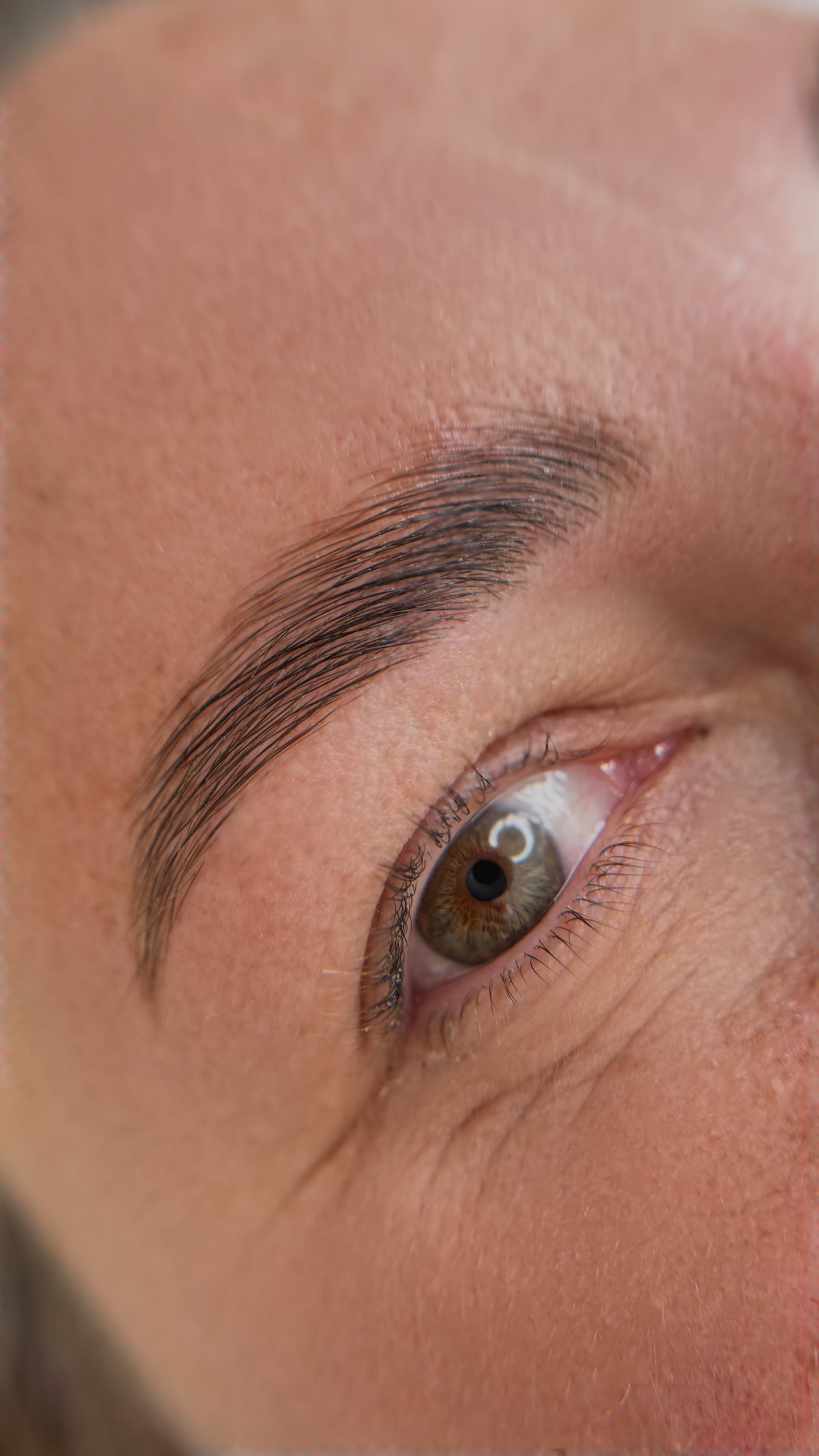 Gelegte Augenbraue nach dem Lifting, grünbraunes Auge